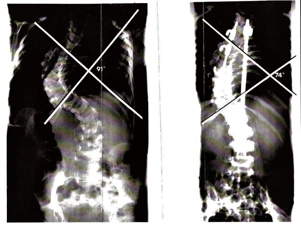 X-ray image with contrast of RIK.